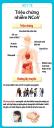 Bo Y te trieu chung nhiem nCoV.jpg - 